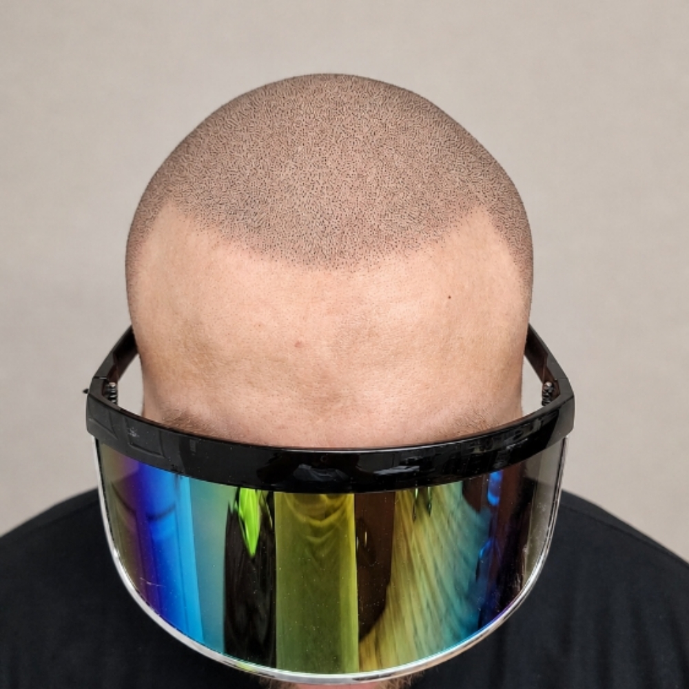 Custom Scalp Micropigmentation at Lumi Ink Studio PMU & SMP in Bartlett, IL