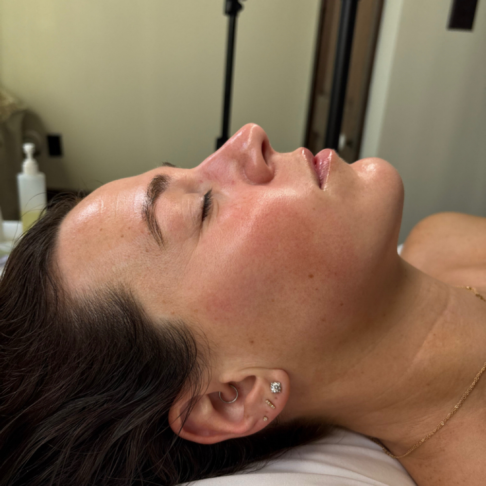 Luxe Lift Facial at Sam W Aesthetics in Florence, AL