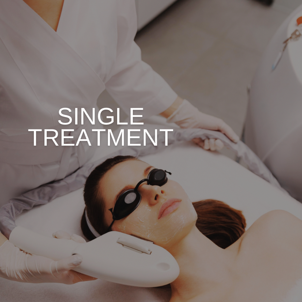 IPL Photofacial Treatment at PRYSM LIGHT in West Burlington, IA