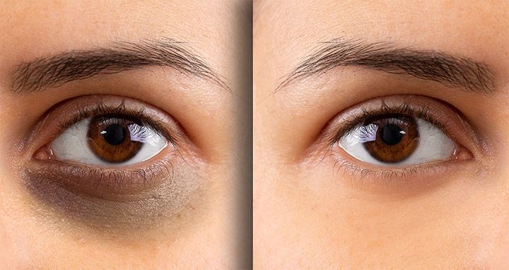Bright Eye Boost