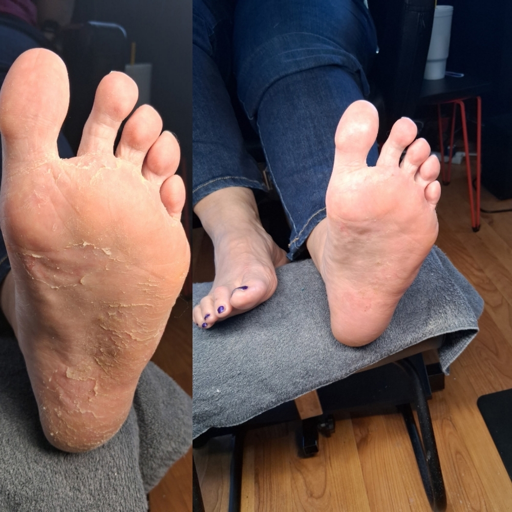 Callous Reduction at Celestial Nail Studio in Johnson City, TN