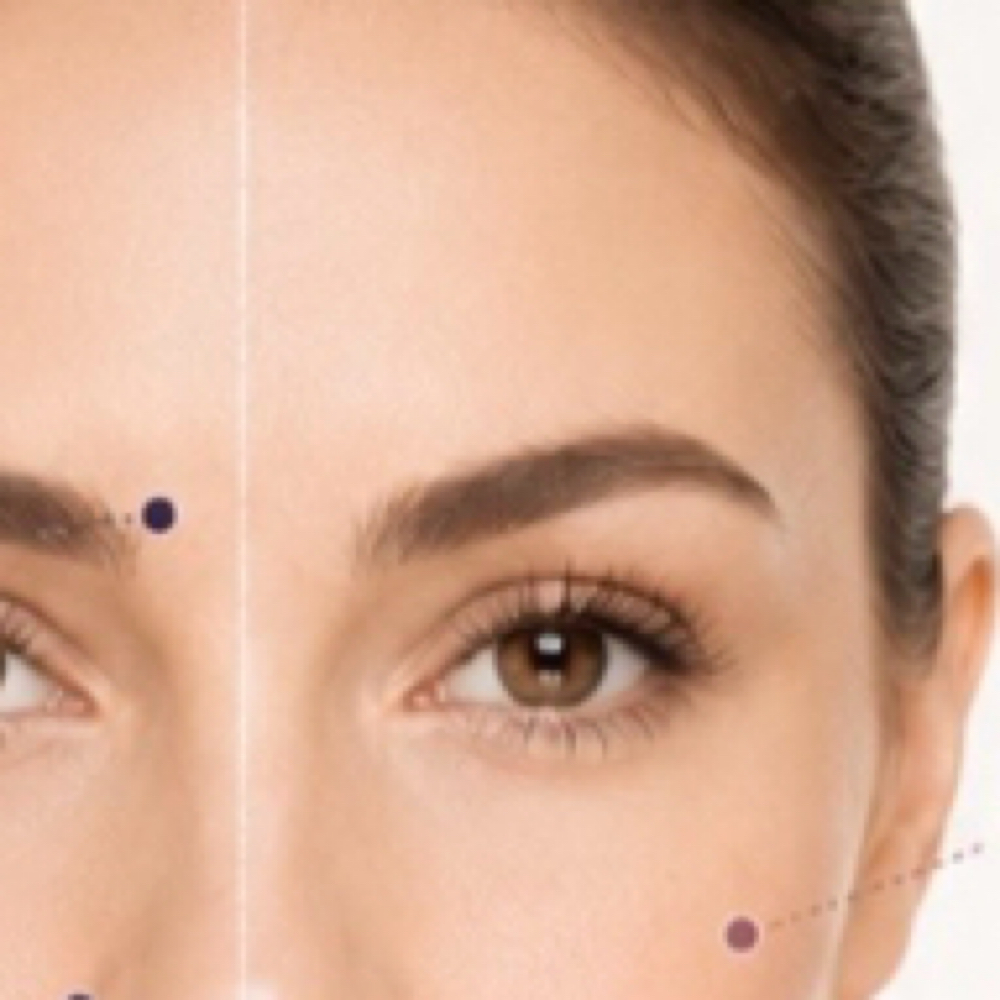 Tear Troughs “EyeBags” $150+ at Finesse Sculpt Body Studio LLC in Joppa, MD