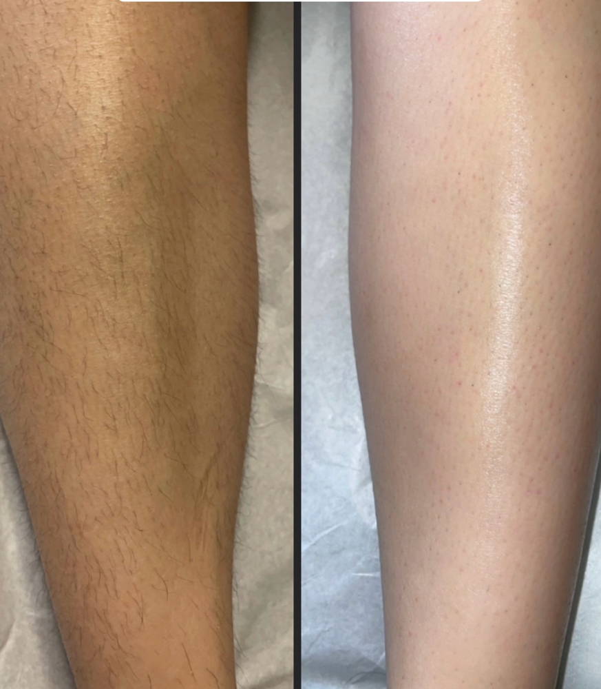 Full Leg Wax