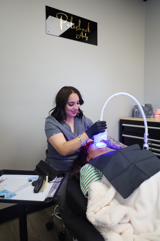 $100 SPECIAL TEETH WHITENING