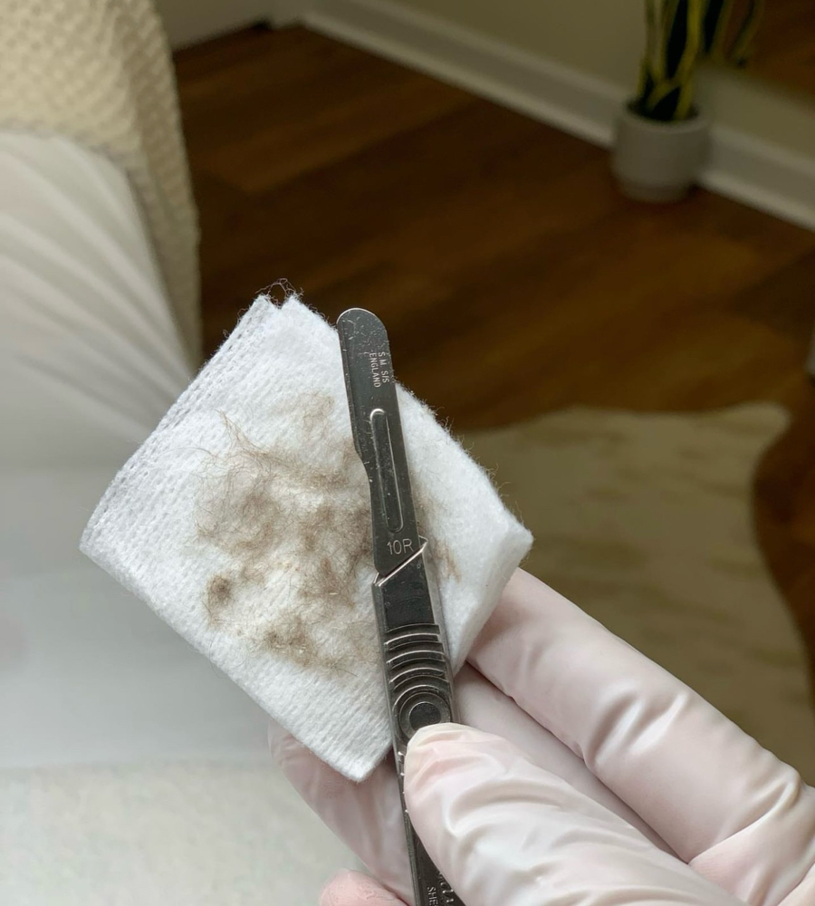 GLASS SKIN DERMAPLANE FACIAL