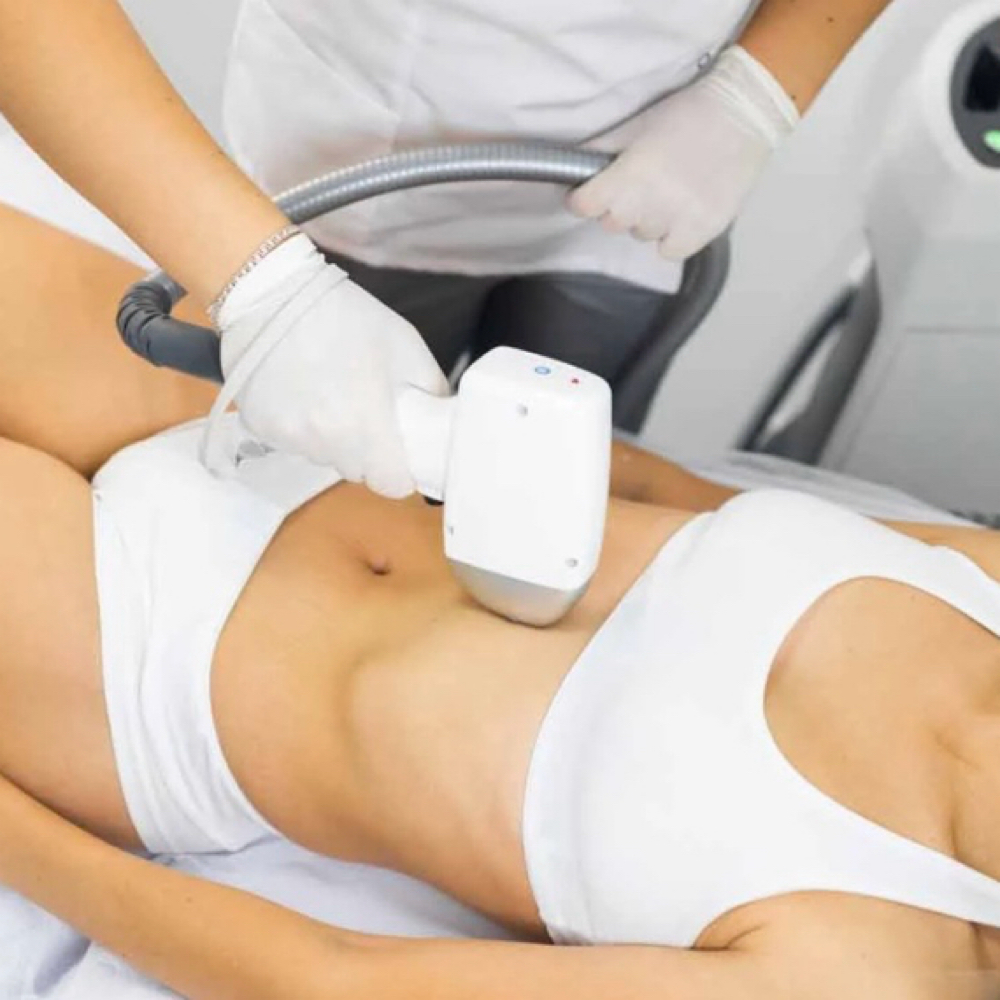 Whole Stomach Laser - 5 Sessions at Blessed & Bare Laser Studio in New York, NY