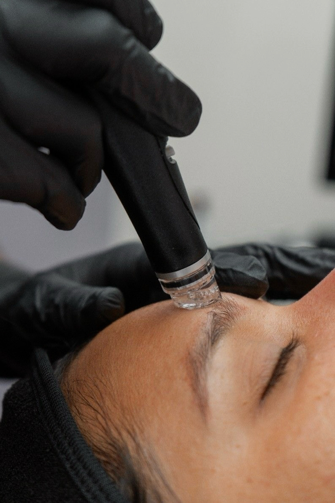 HydroFacial at Kathy's Skinbar in Fort Payne, AL