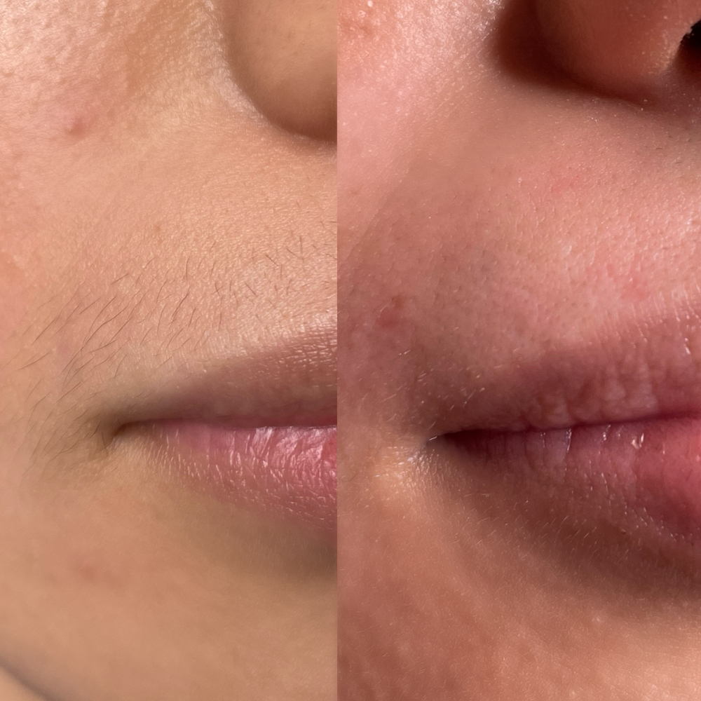 Lip Wax