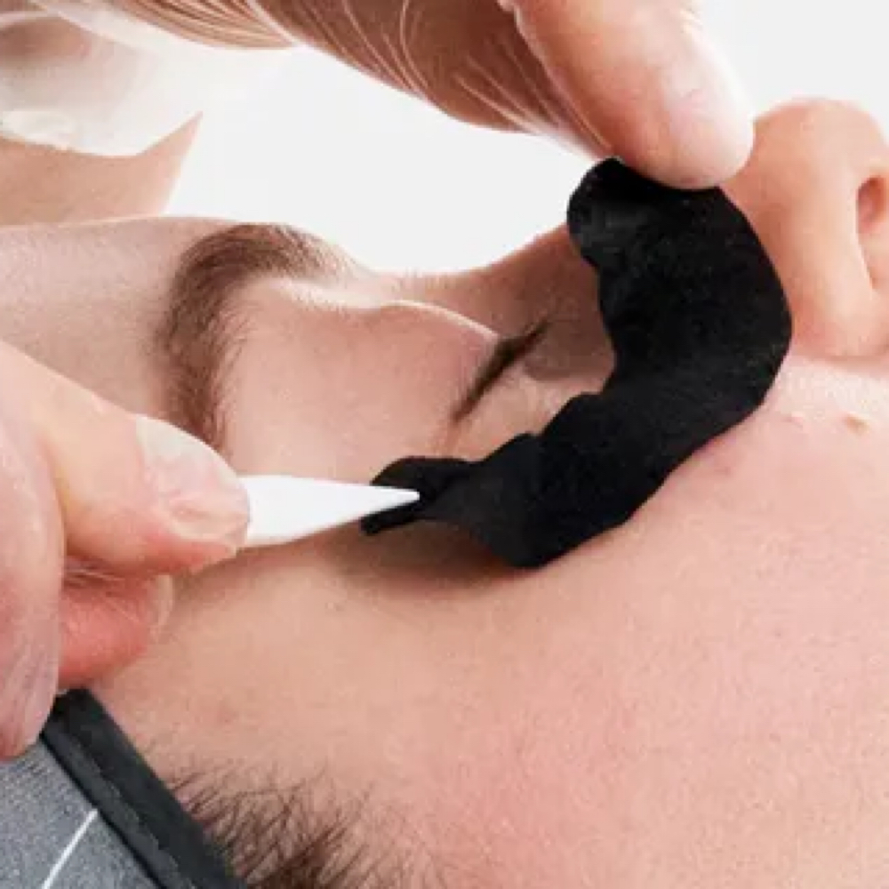 Advanced Eye Peel Add On at Serenity Spa Services in Altoona, PA