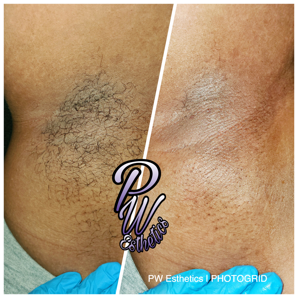 Underarm Wax