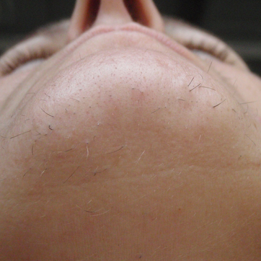 Chin Wax at Nakeesa  Salem in Wilsonville, OR