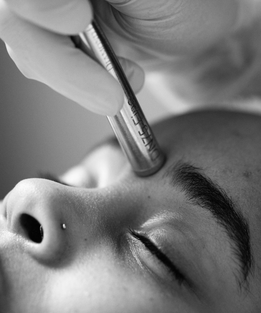 Microdermabrasion Facial