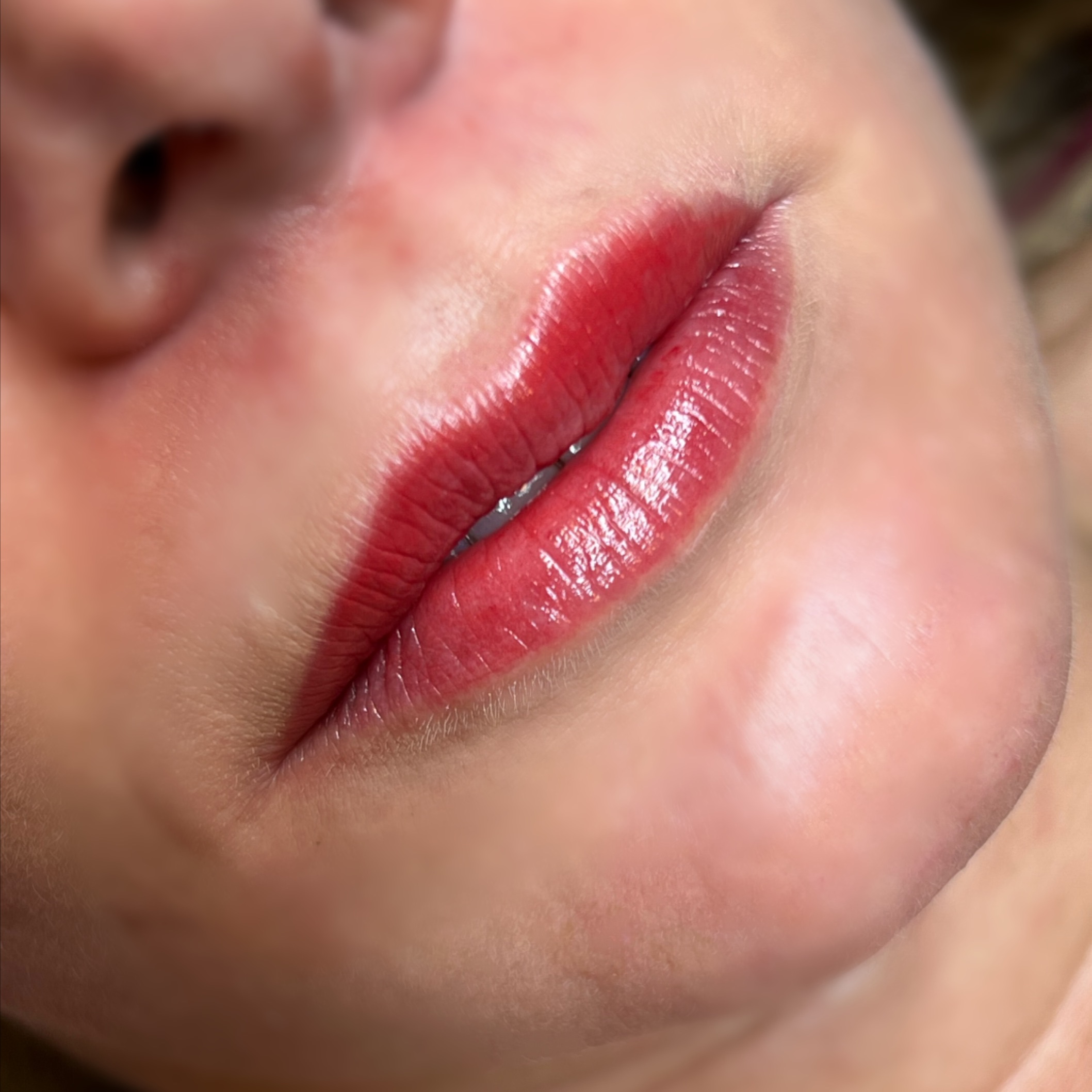 Lips Perfection Touchup (6-8 weeks)