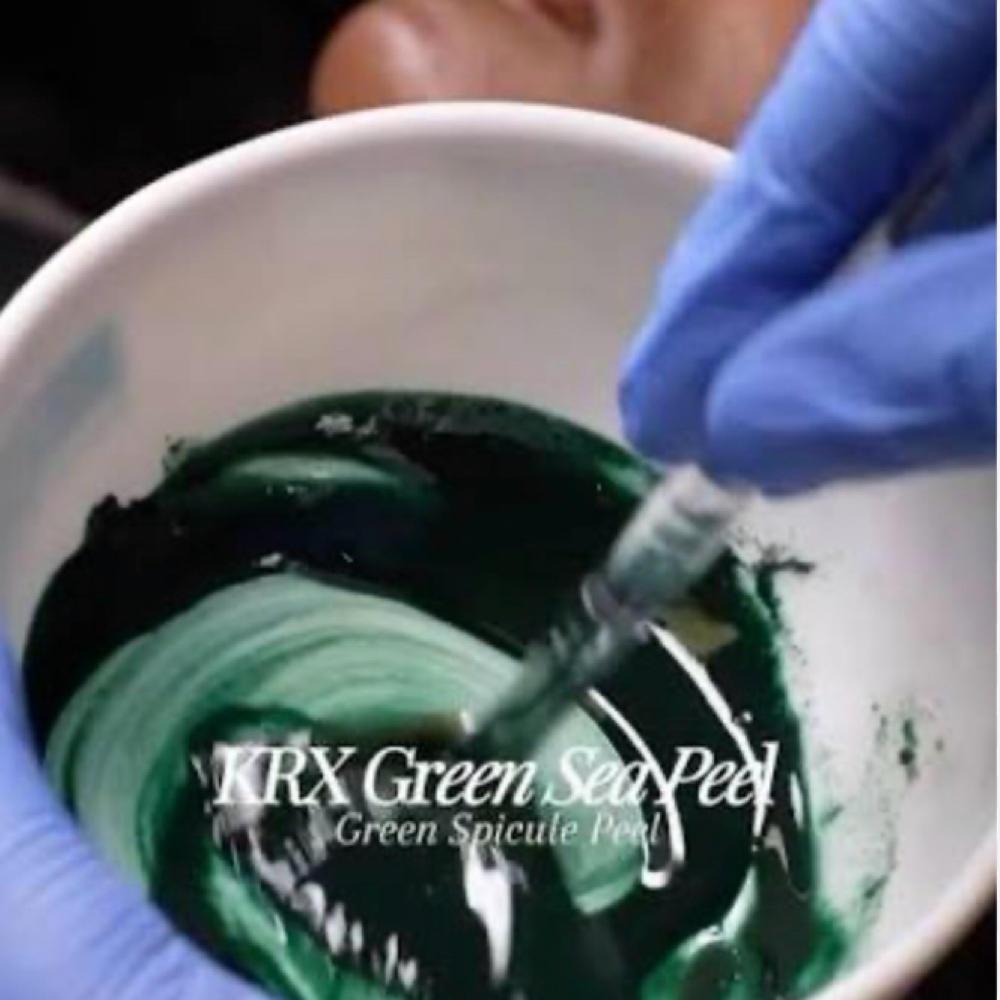 Green Sea Peel at Soothing Skin Sanctuary in Mesquite, TX