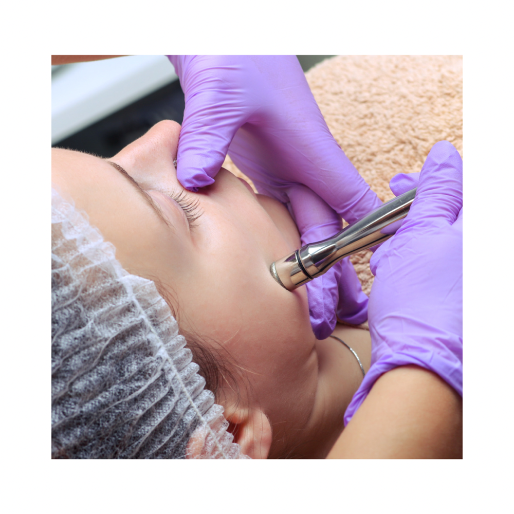 Microdermabrasion Facial