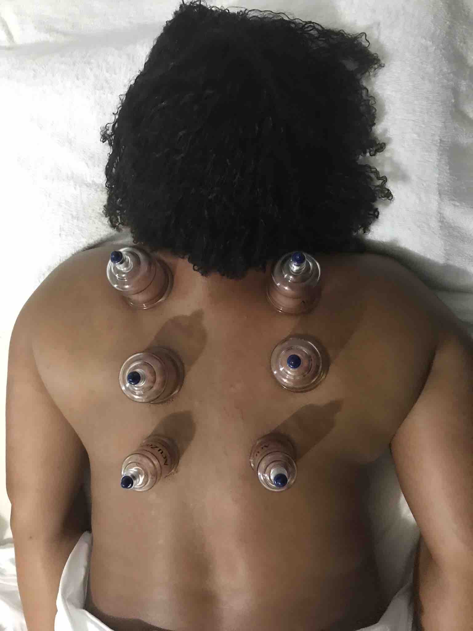 Medi Cupping Massage 60 min