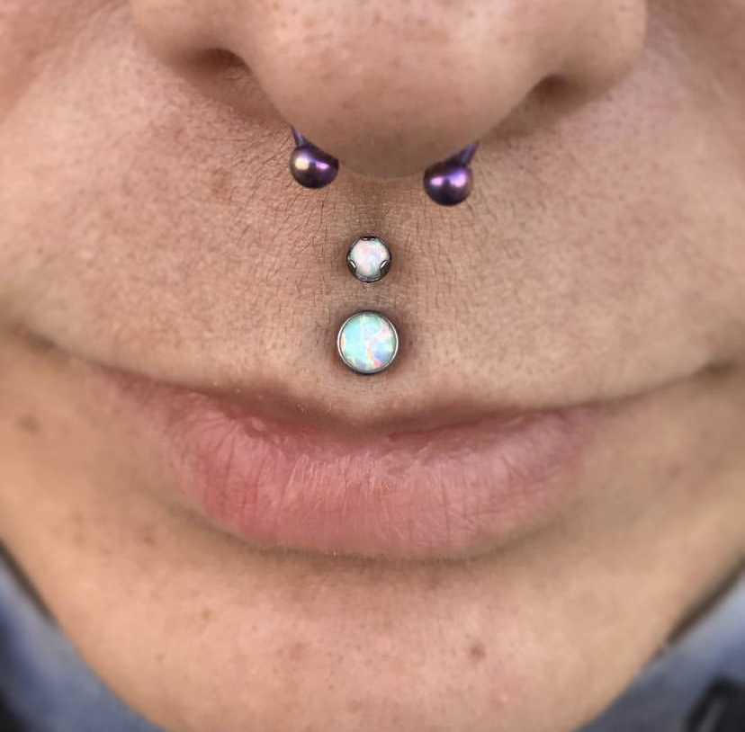 Upper Medusa / Philtrum