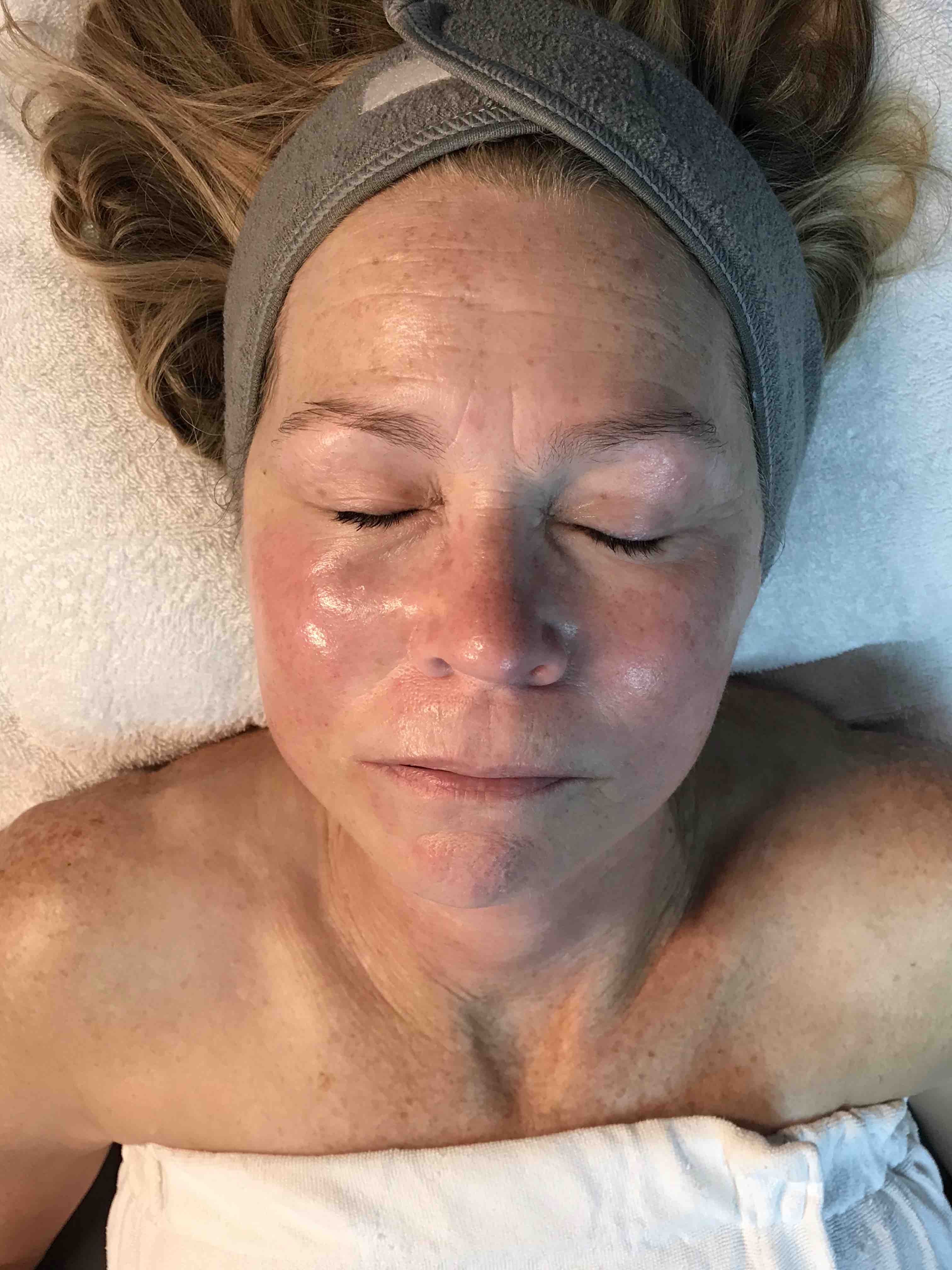 Nano Fusion Facial