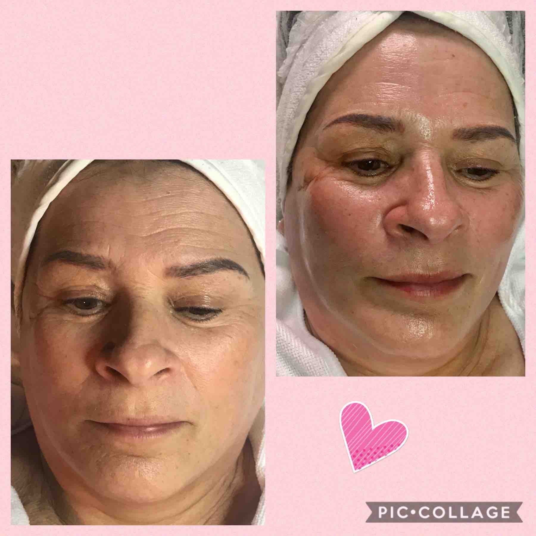 Ageless Facial