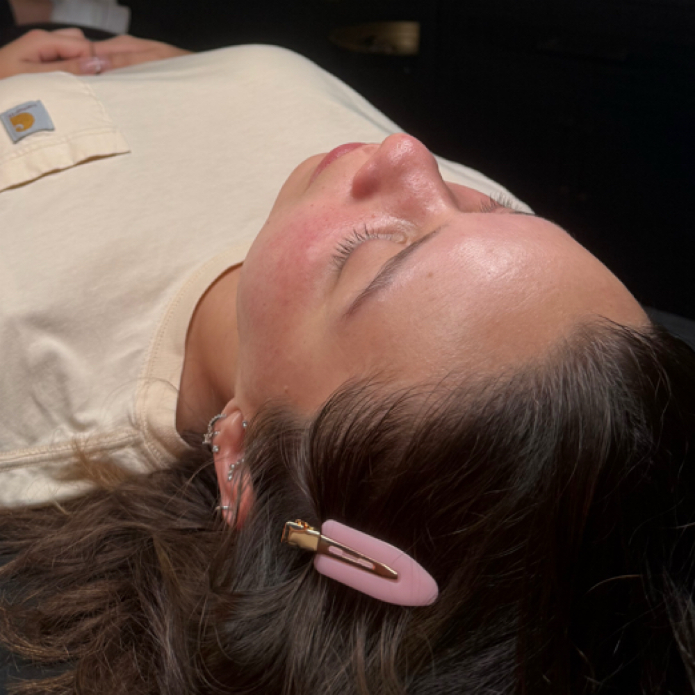 BIWEEKLY ACNE TREATMENT at Lashes+corrective skincare+waxing+brows in Temecula, CA
