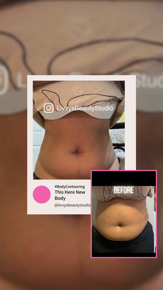 This Here New Body at Livvy’sBeautystudio in Decatur, GA