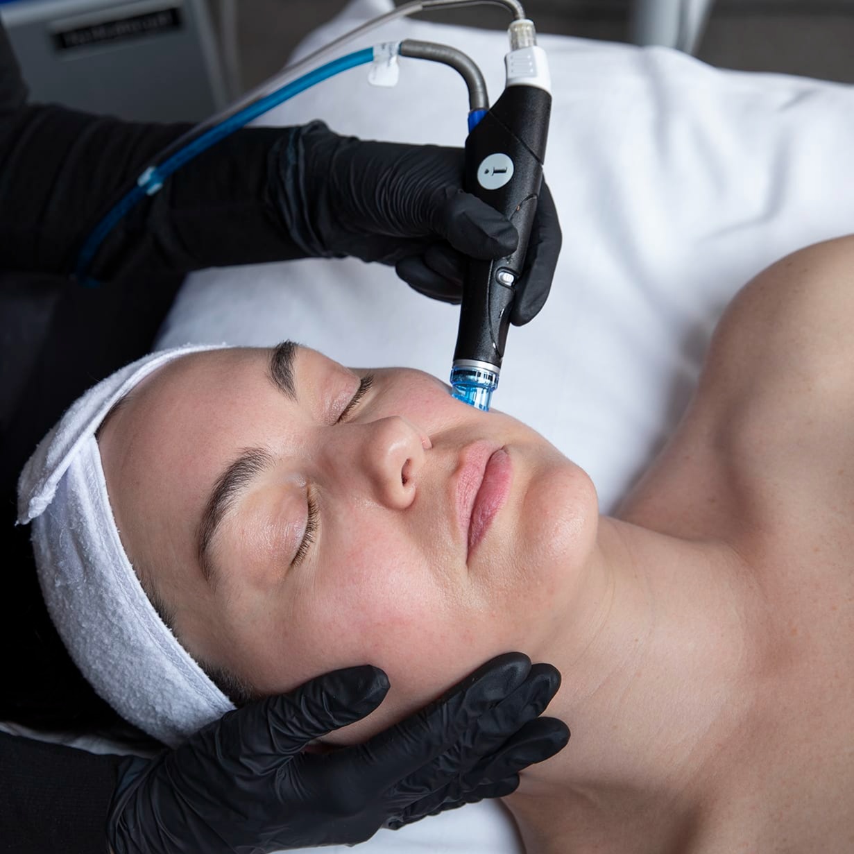 HydraFacial Treatment at GloVolution LLC in Homosassa, FL
