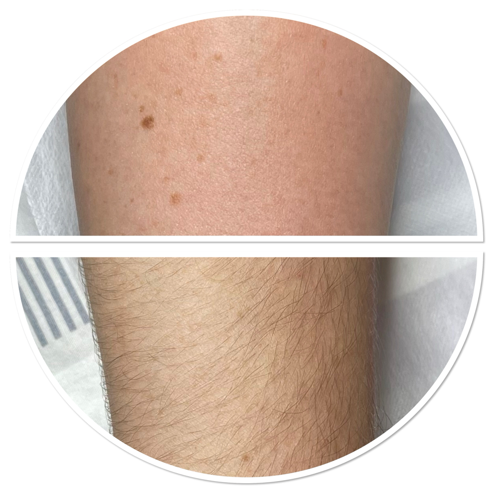 Women Full Arms Sugaring