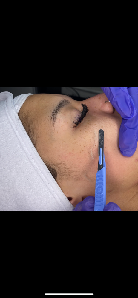 Dermaplane Facial at Esthetics By Marina in Fort Smith, AR