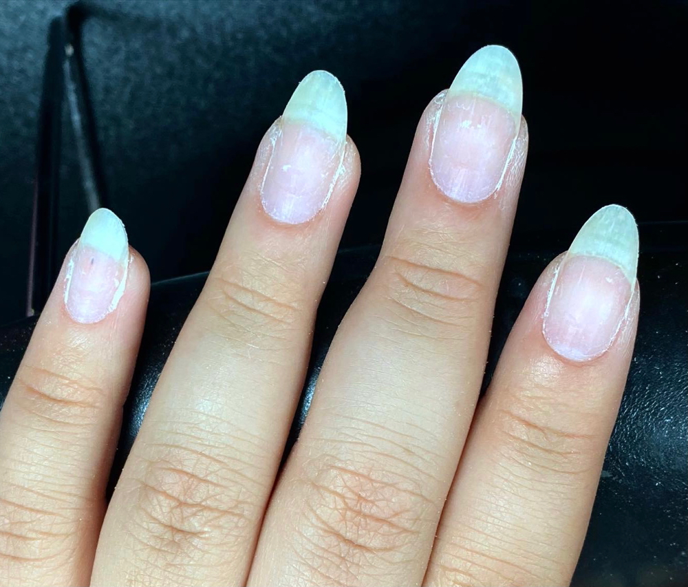 ADD ON: Nail Patch (Cracked Nail)