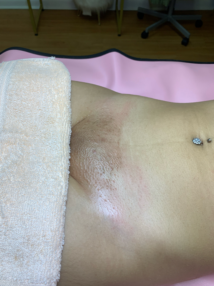 Bikini Full Wax
