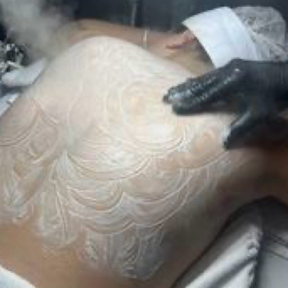 Back Facial at HER ERA in Eatontown, NJ