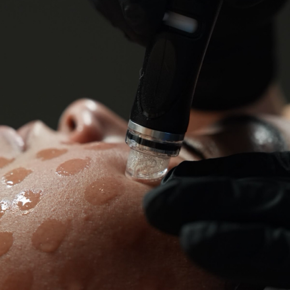 Hydrafacial💧 at Kenzy.esthetics in Hobart, IN