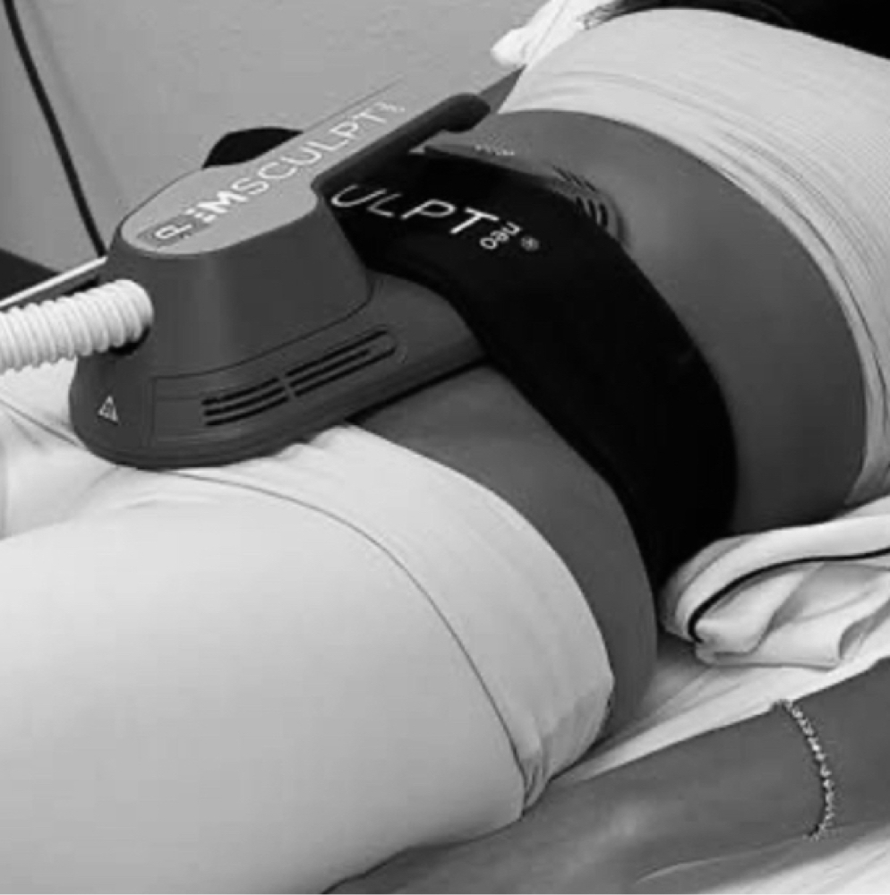 4 Cavitation + 4 Ems Sculpt Add On at StarLuxeSpa in Sacramento, CA
