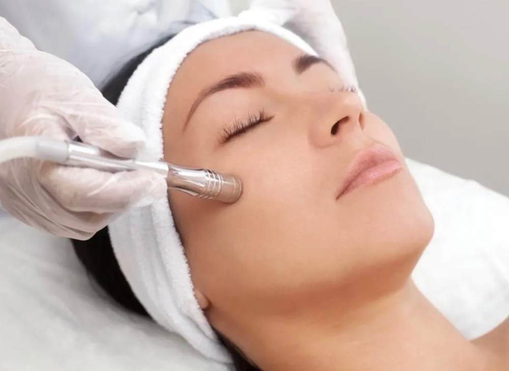 Microdermabrasion