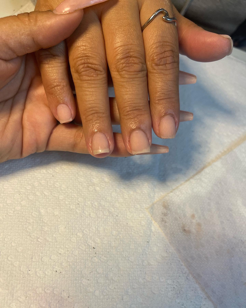 Gel Removal