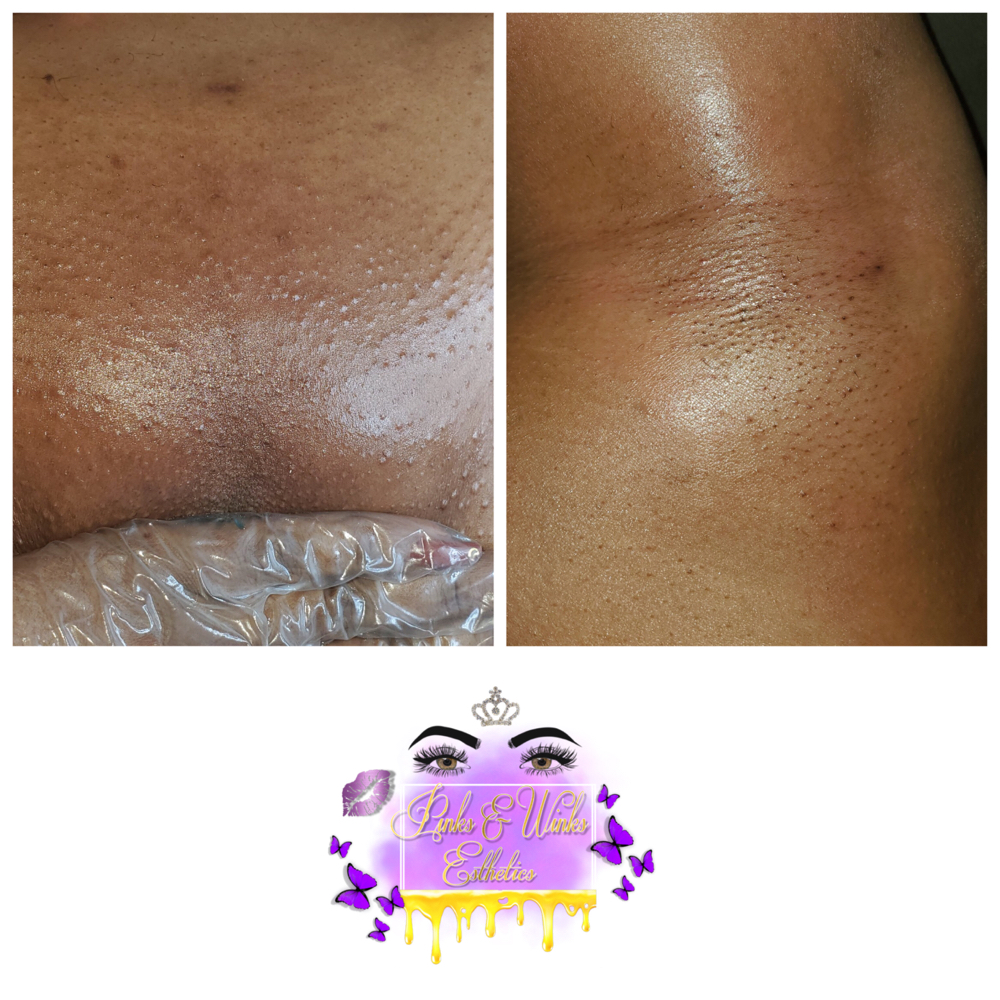 Brazilian & Underarm Wax