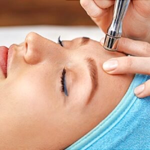 Microdermabrasion Facial