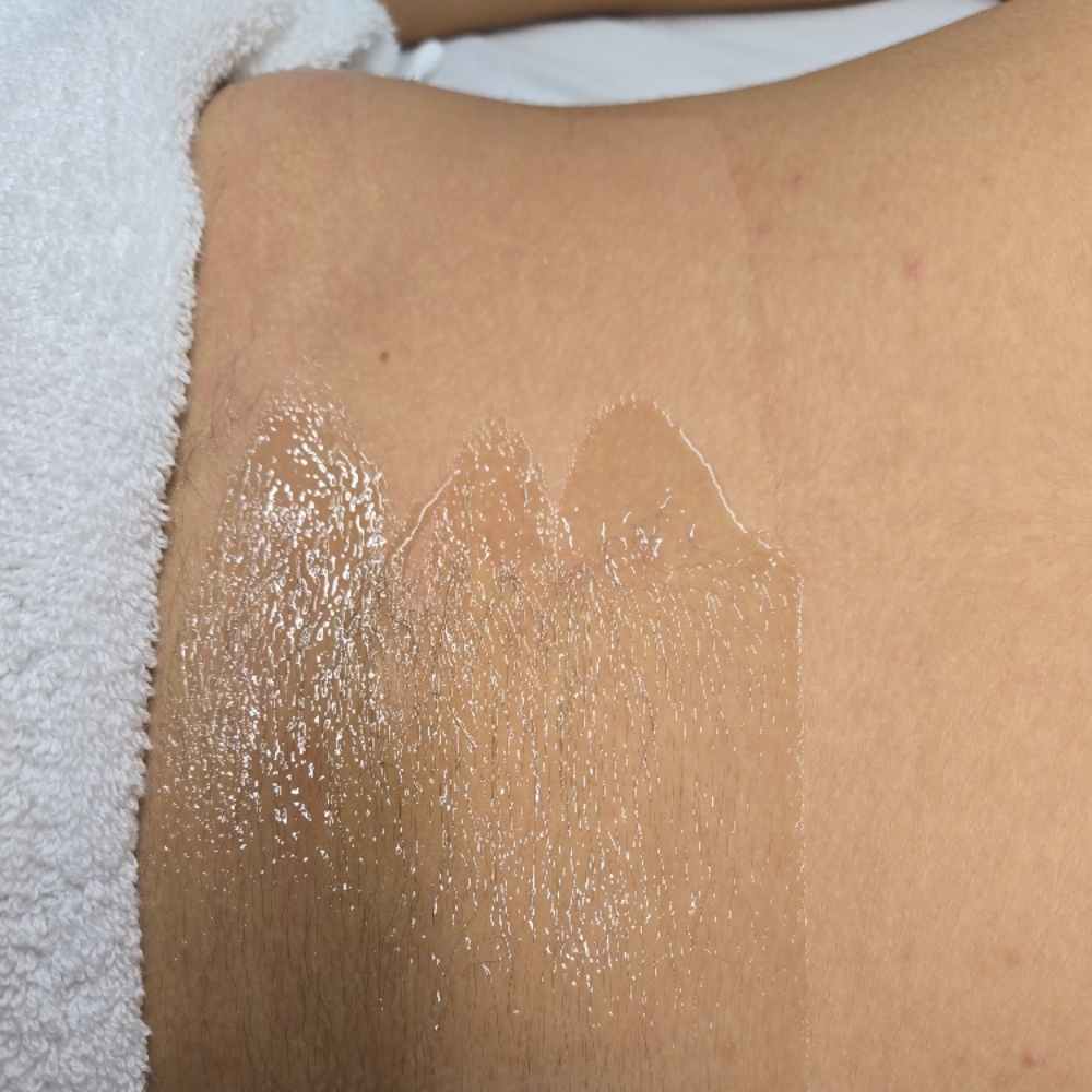 Back or Chest Wax at Midtown Esthetics in Raleigh, NC
