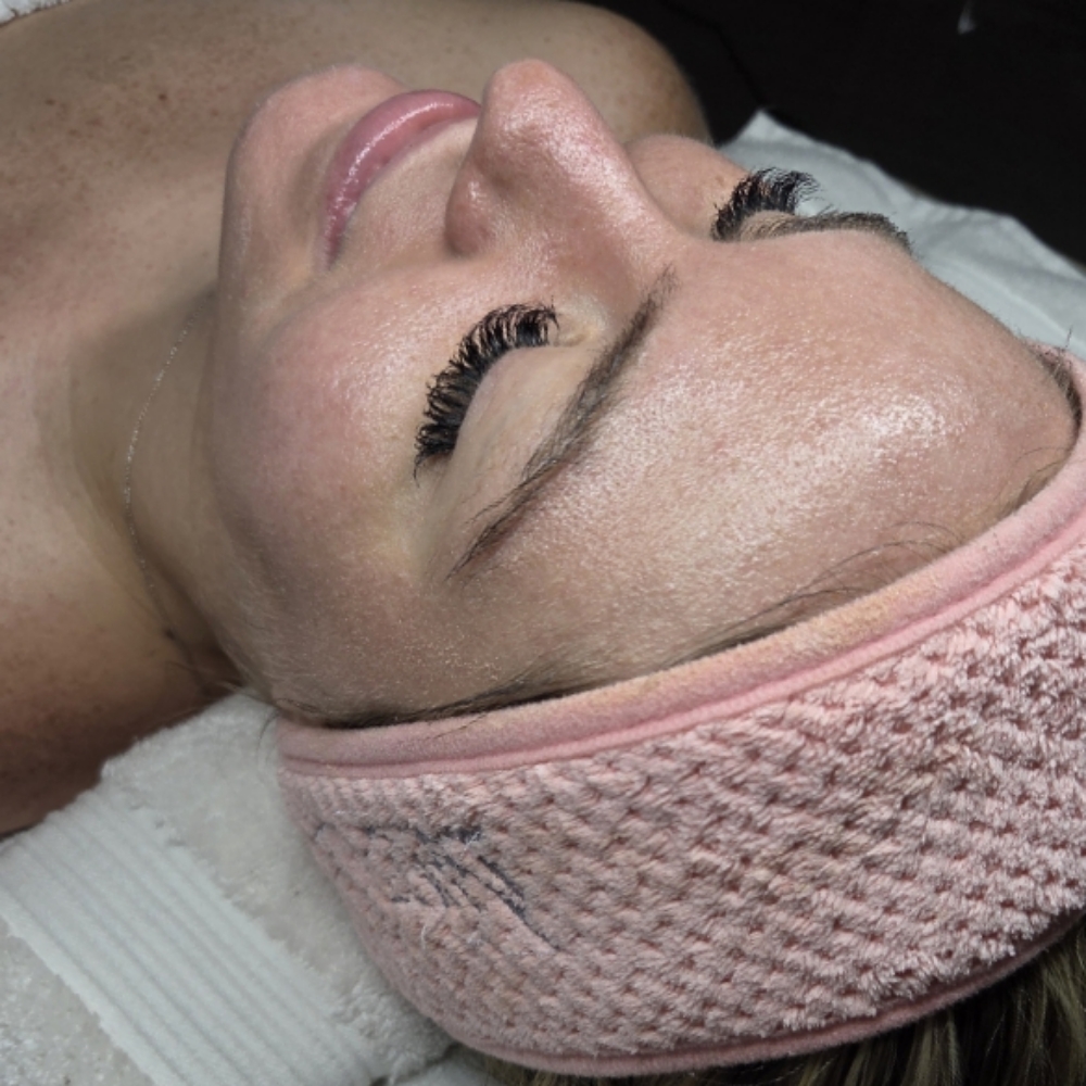 Summer Skin Reset Facial at Lavish Face & Skin SPA LLC / Med Spa in San Antonio, TX
