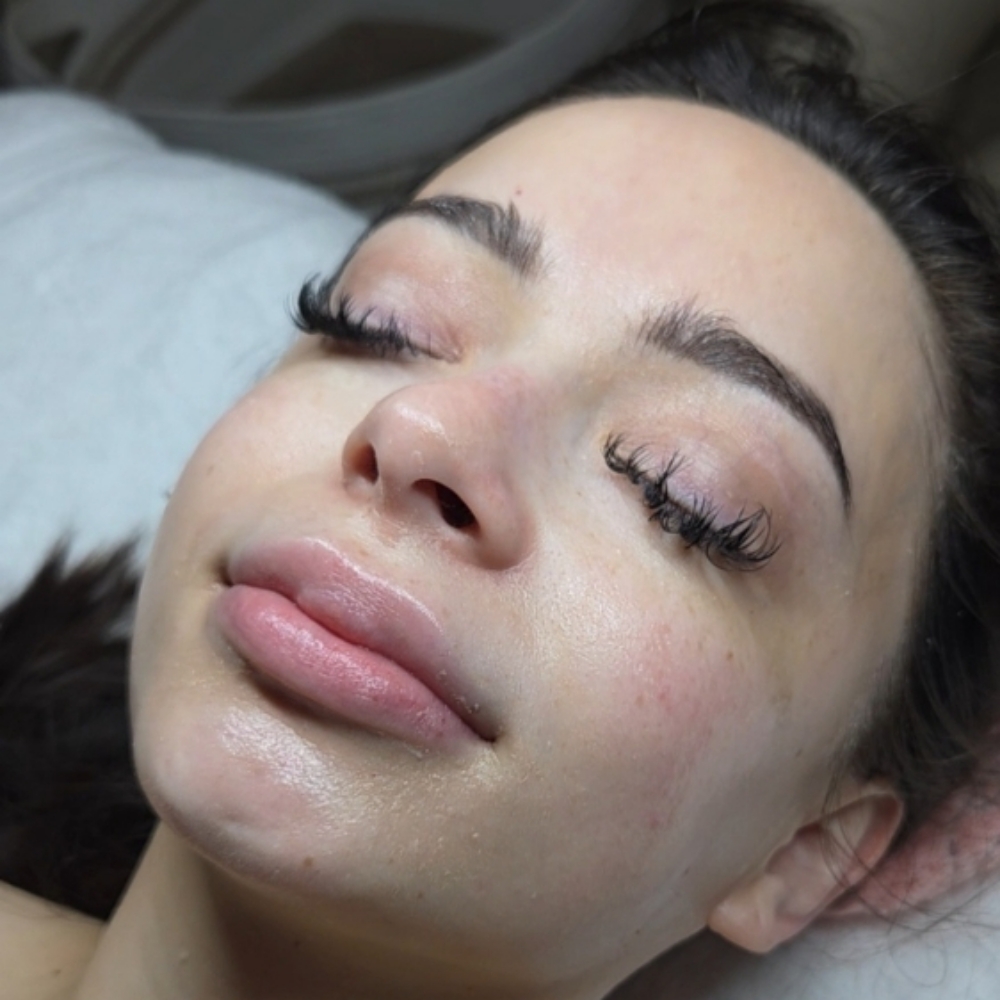 Summer Skin Reset Facial at Lavish Face & Skin SPA LLC / Med Spa in San Antonio, TX