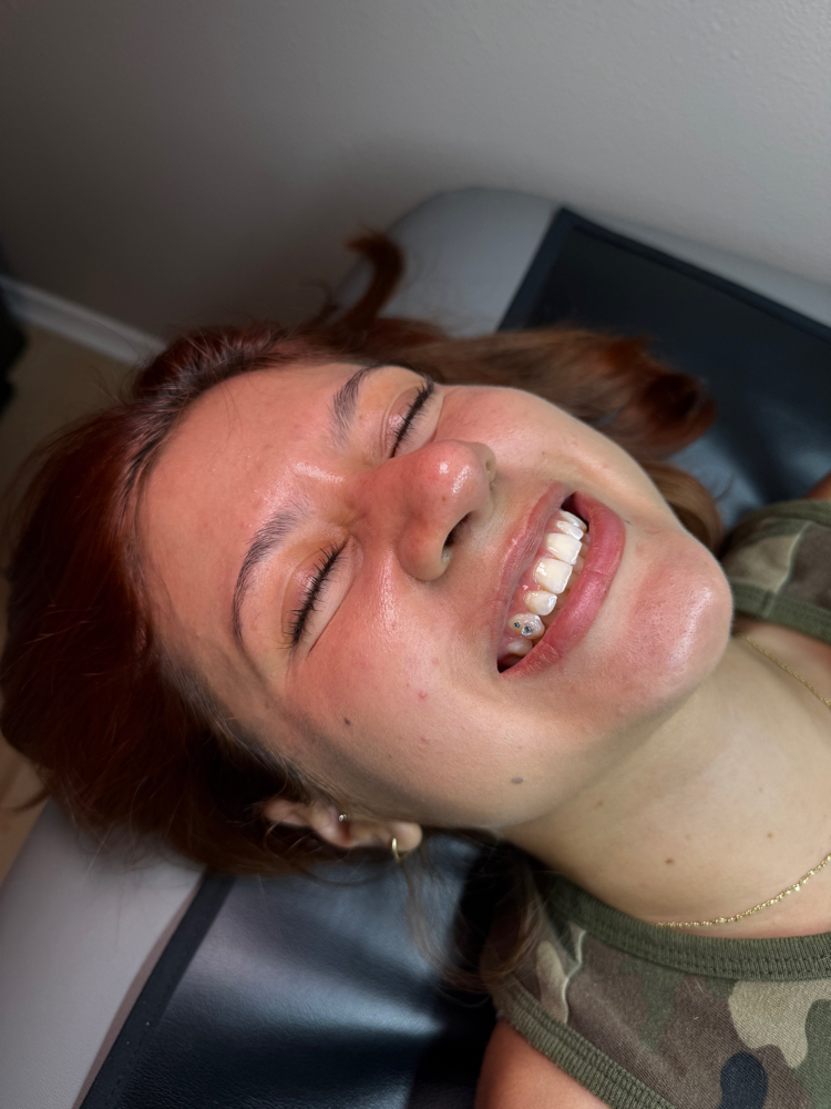 Tooth Gems at Pretty Gals Esthetics in San Antonio, TX