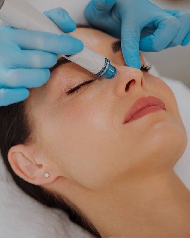 Hydrodermabrasion Facial