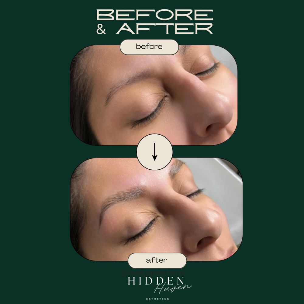 Brow Lamination