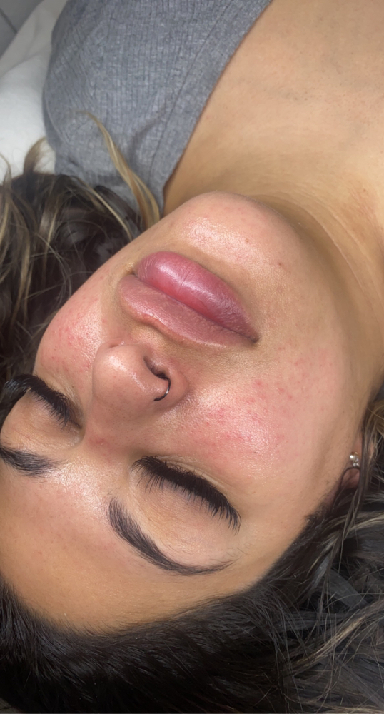 Custom Facial