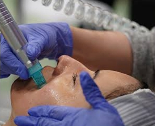Hydro Dermabrasion