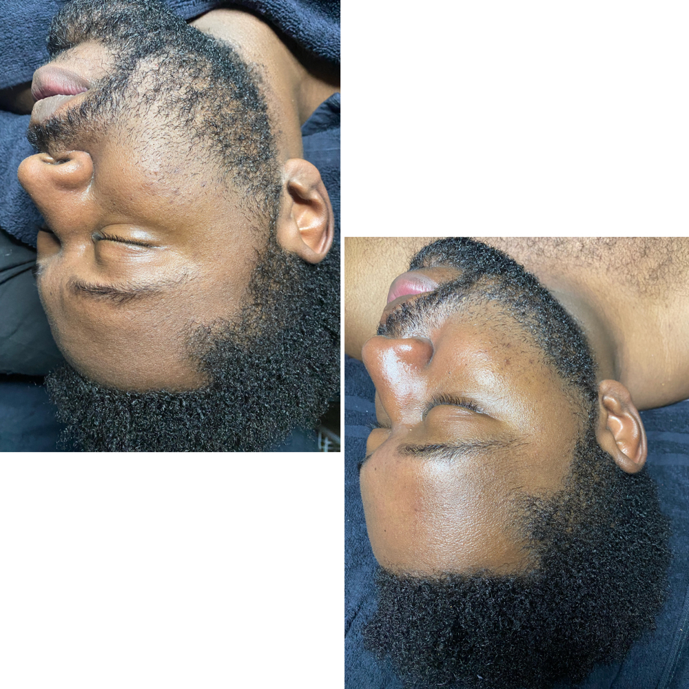 Enzyme Radiance Facial