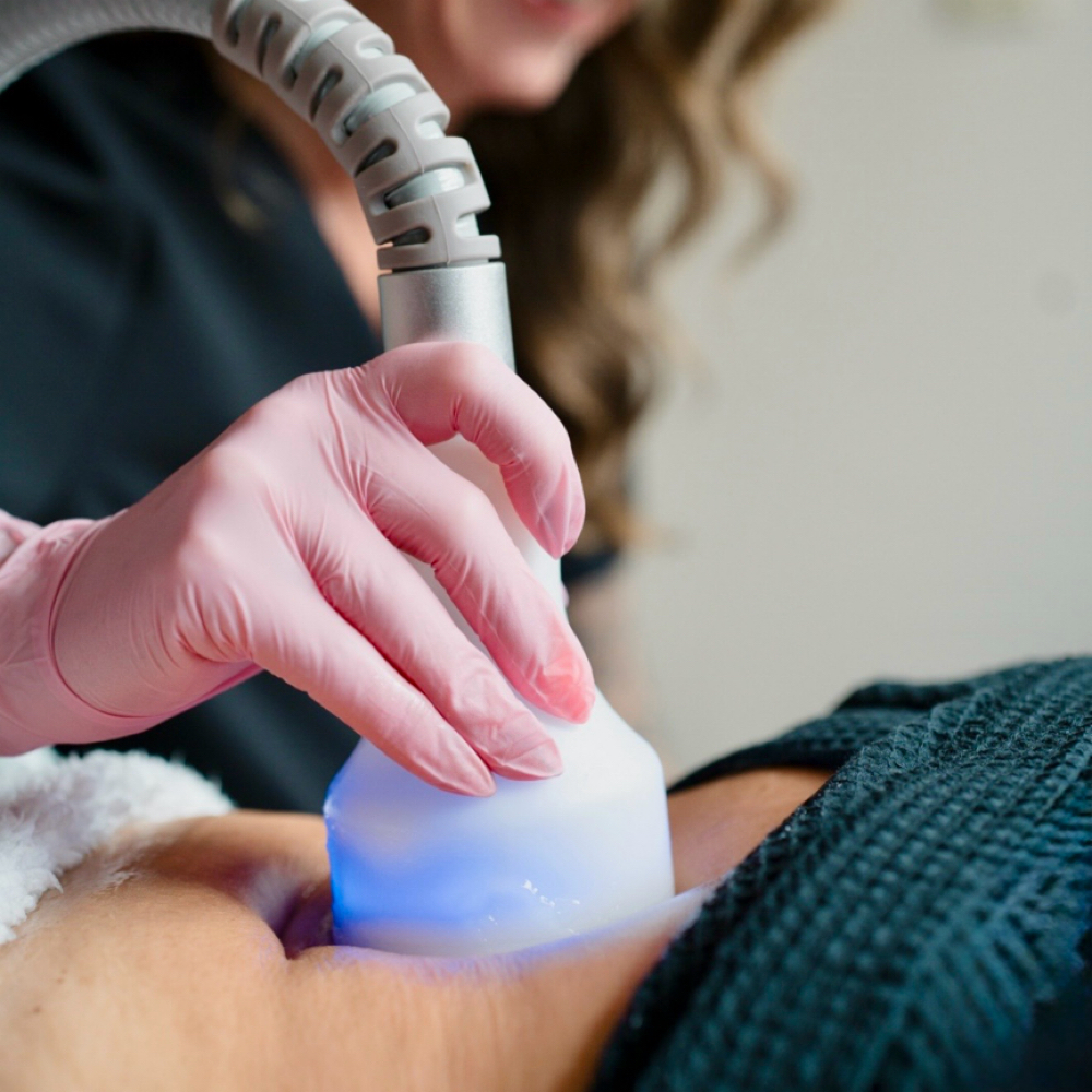 CryoSlimming OR CryoToning Packages at Below Zero Cryo & Beauty in Morgantown, WV