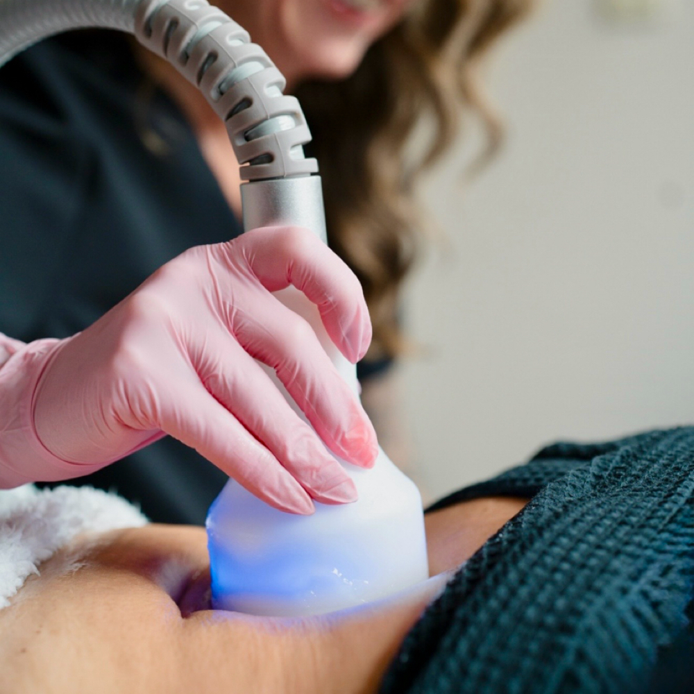 CryoSlimming OR CryoToning Packages