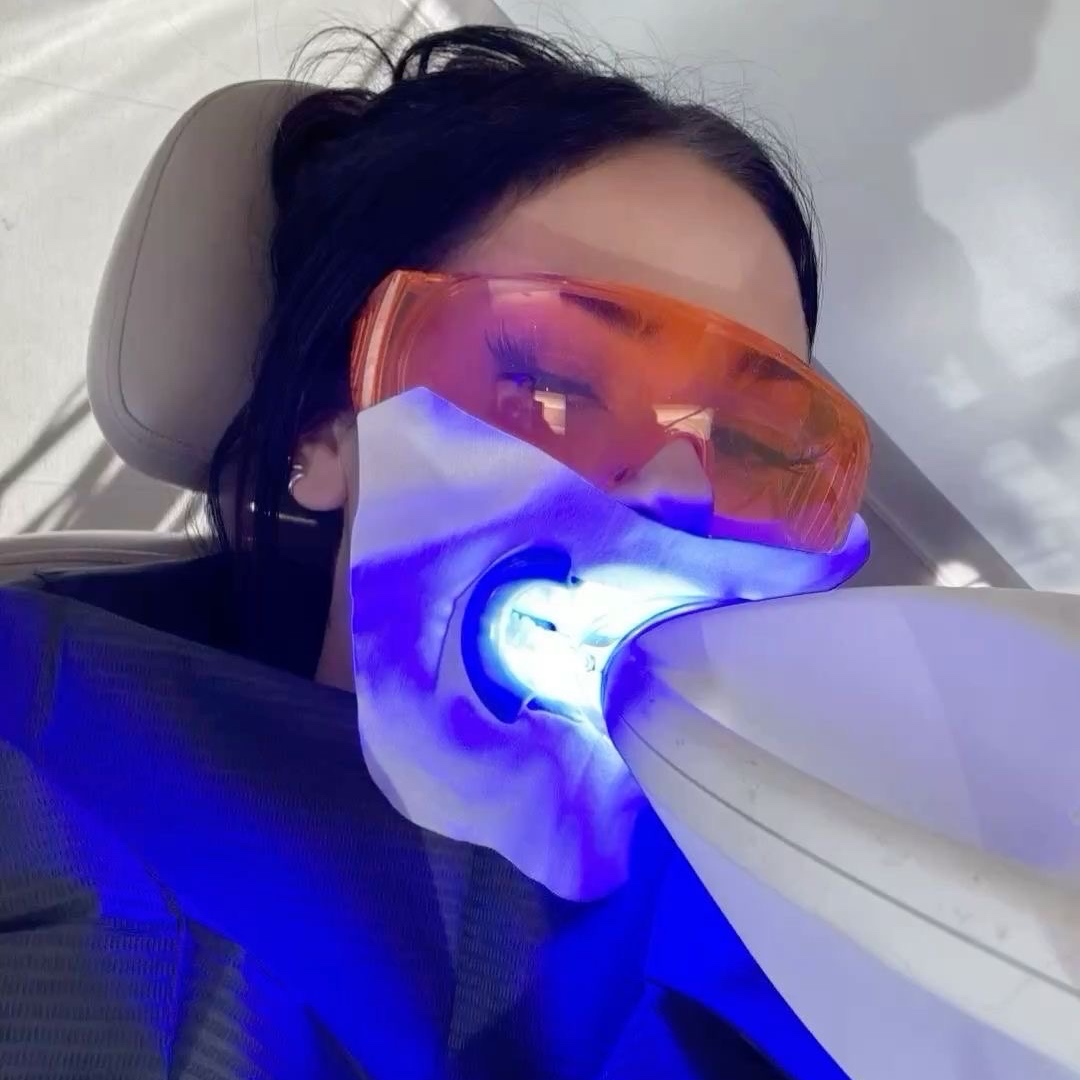 Cosmetic Mini Whitening at Sparkle Smile Spa LLC in Chandler, AZ