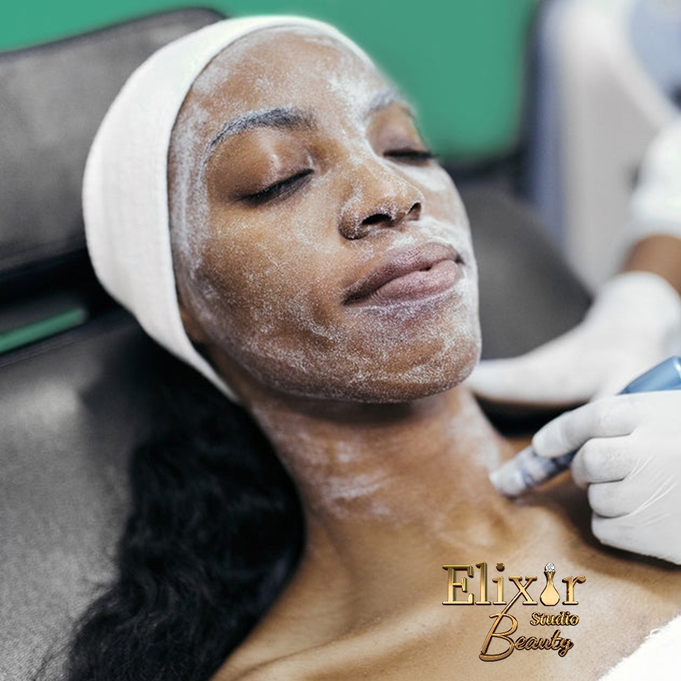 Crystal Microdermabrasion